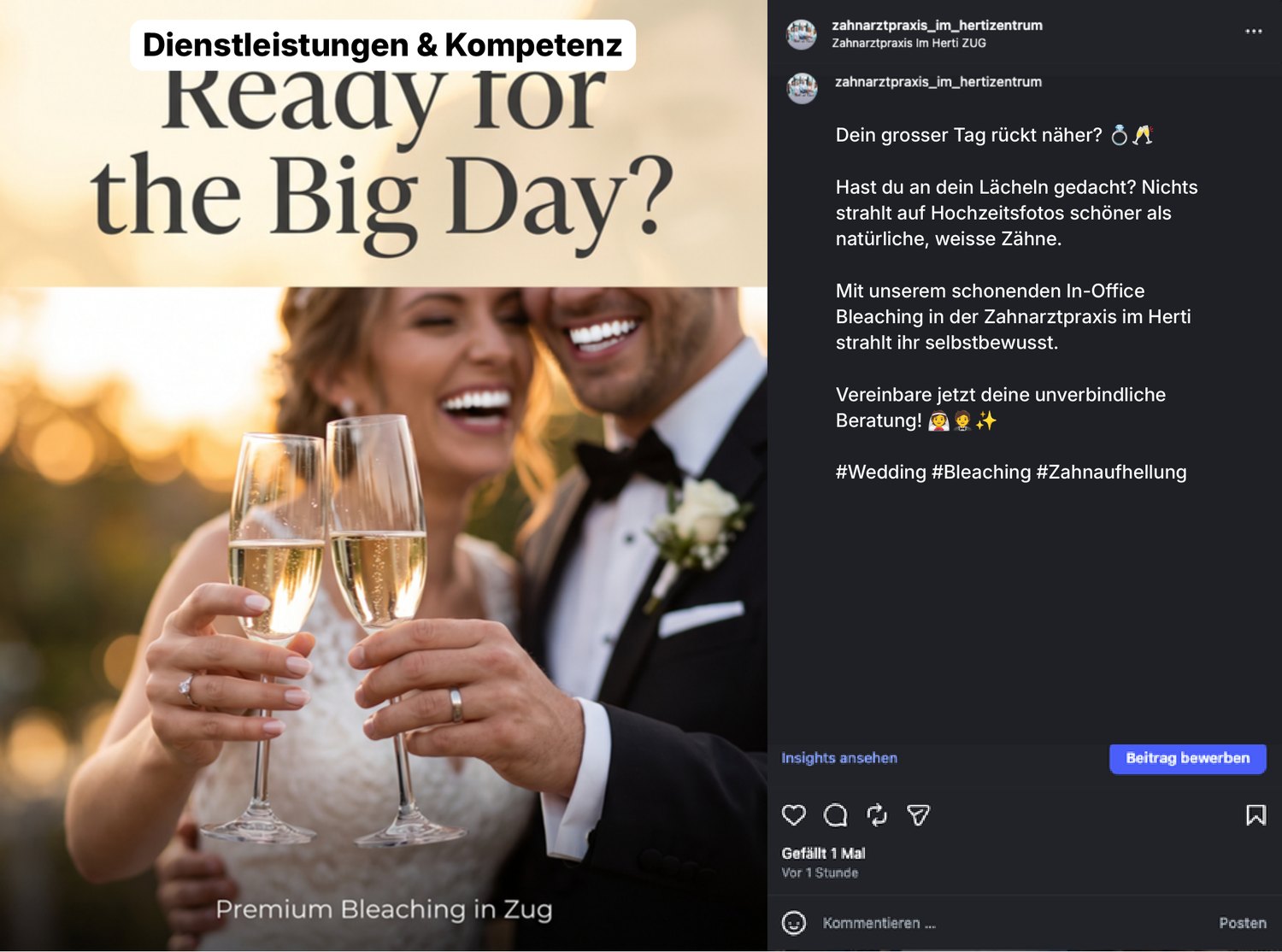 Post-Vorschlag 15 — „Ready for the Big Day?“ — Bleaching zur Hochzeit.